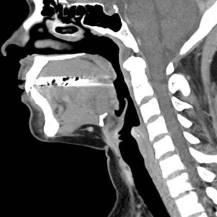 CT Neck Читы