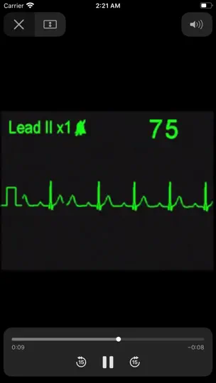 Captura de pantalla de EKG Clínico en iPhone 9