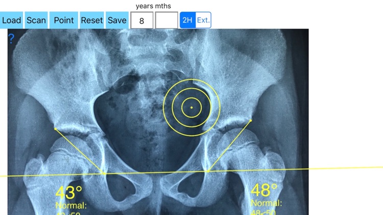 SharpAngleApp screenshot-3