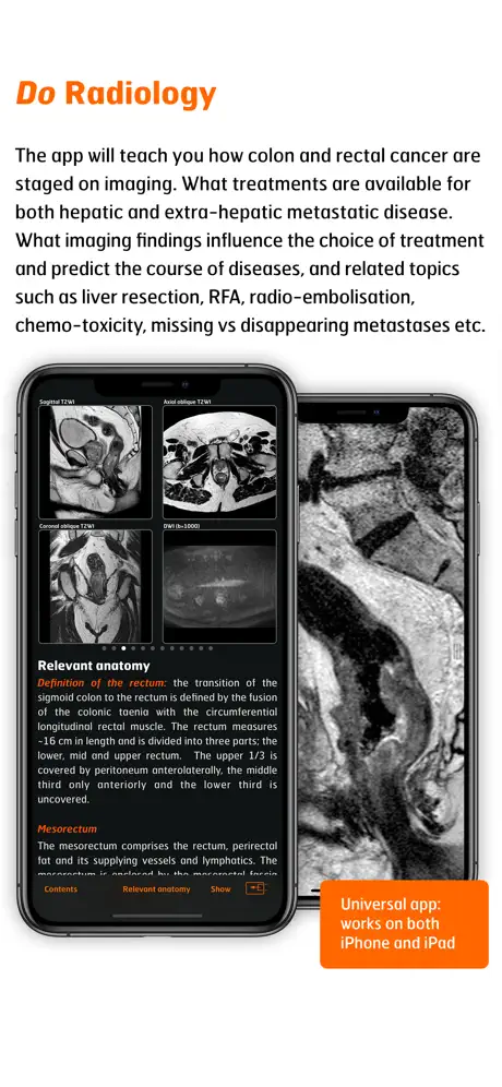 Radiology - CRC Staging Atlas