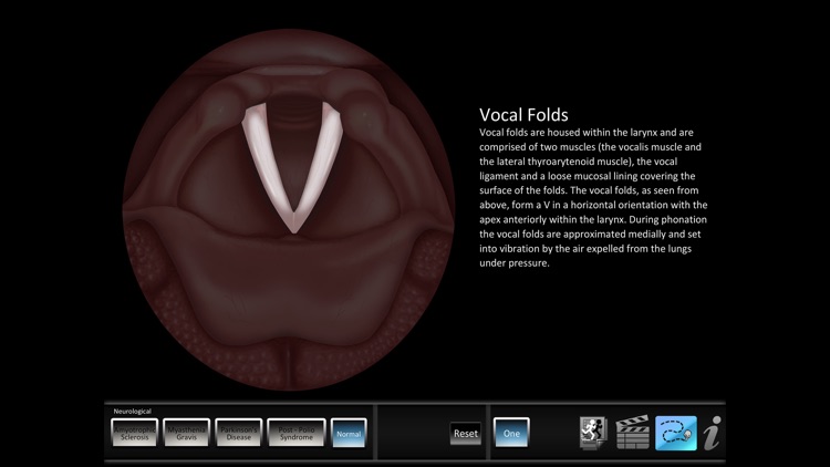 Vocal Pathology: Neurological screenshot-3