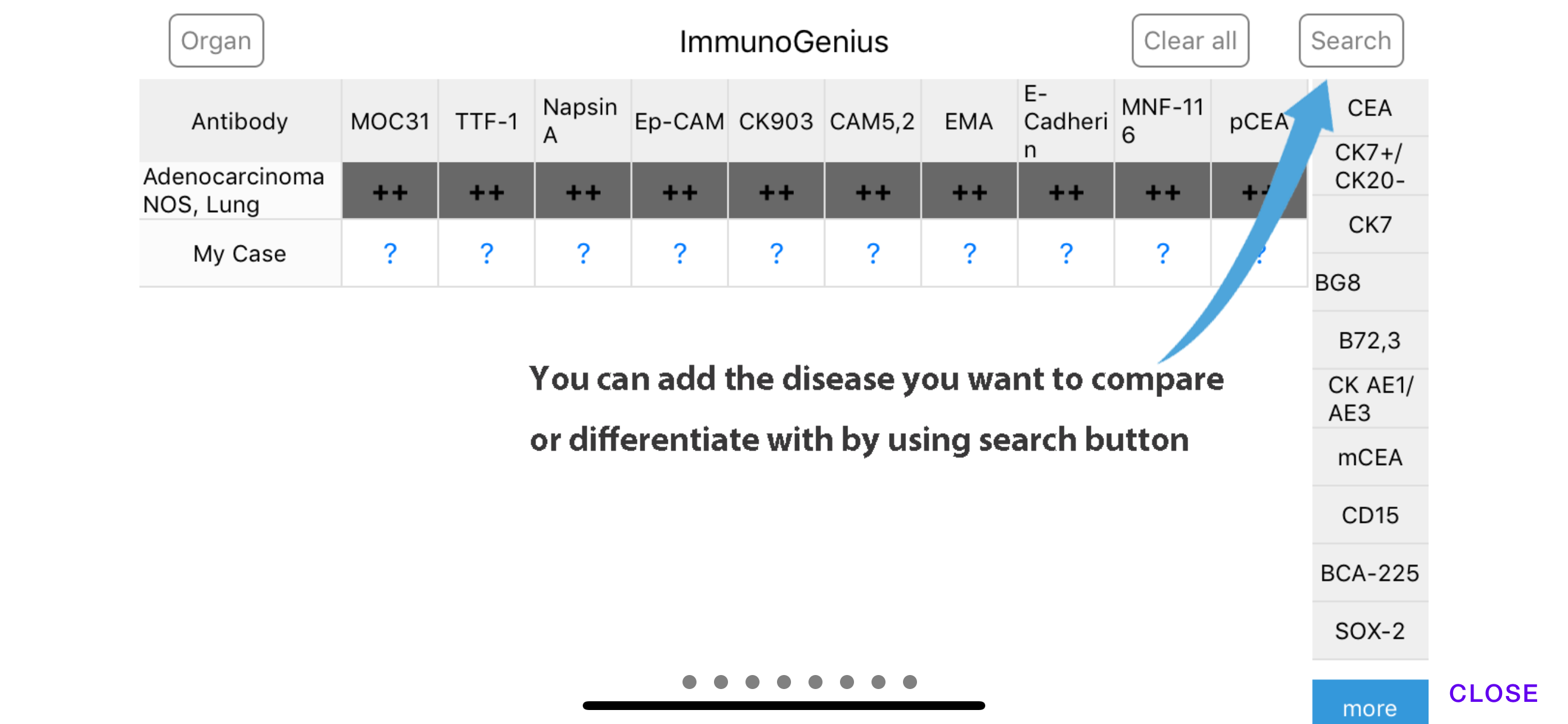 ImmunoGenius