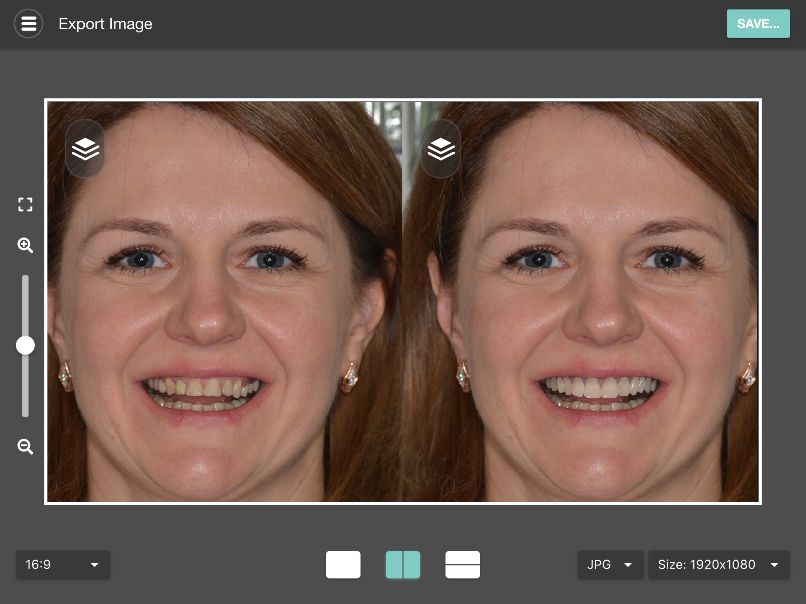 Smile Designer Pro screenshot 4