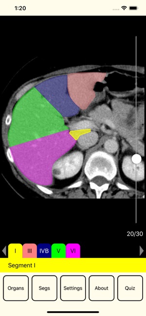 RadAnatomy(圖2)-速報App