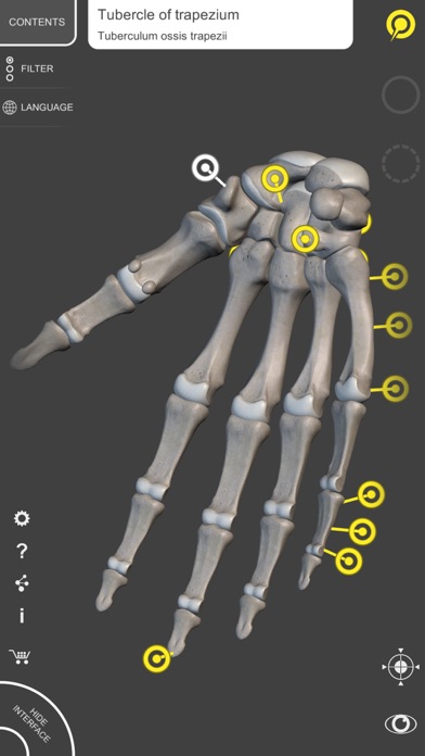 How to cancel & delete Skeleton 3D Anatomy from iphone & ipad 4