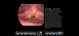 Game screenshot Vocal Pathology: Polyps apk