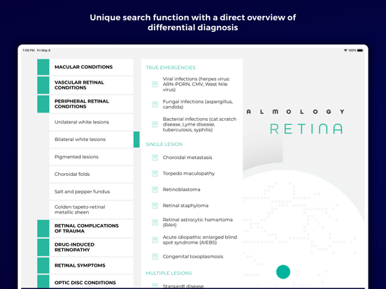 Screenshot #5 pour Focus on Ophthalmology