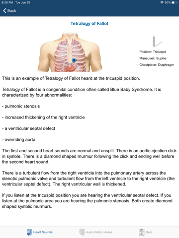 Heart Sounds Auscultation screenshot 3