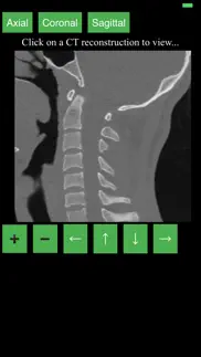 How to cancel & delete ct cervical spine 1