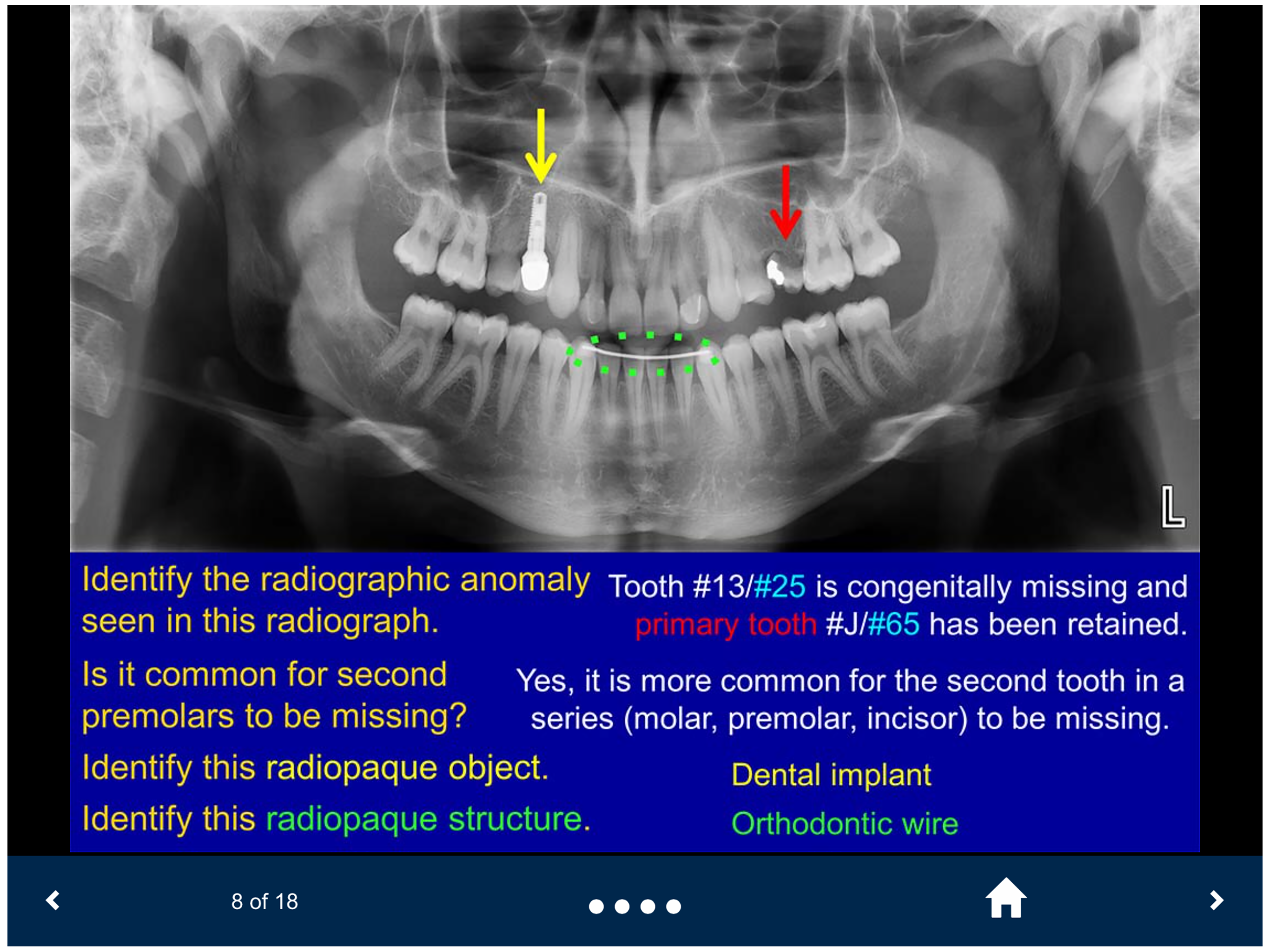 Oral Radiology - SecondLook