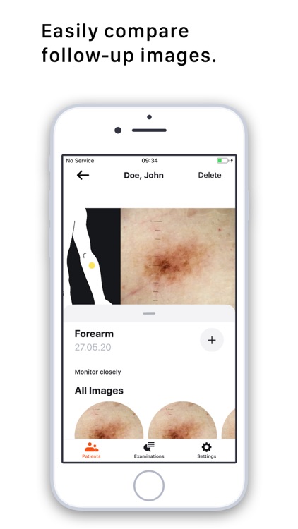 HEINE DERM screenshot-4