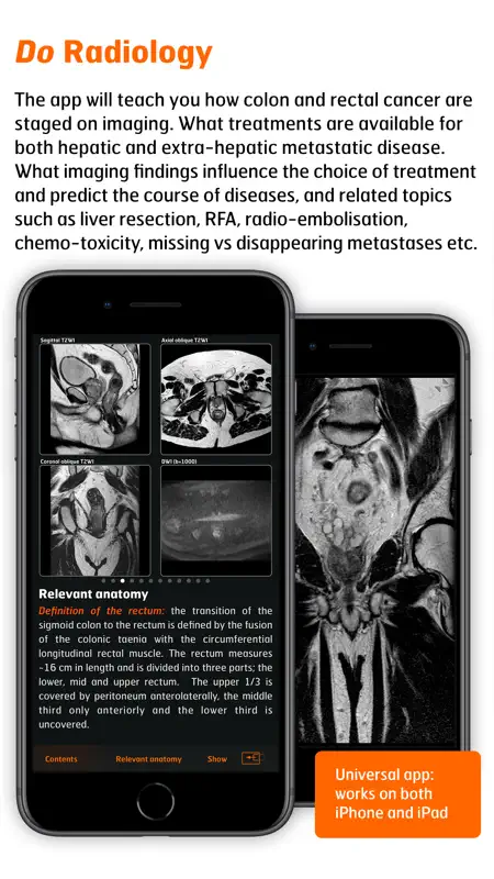 Radiology - CRC Staging Atlas screenshot 3 of 5
