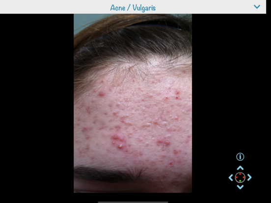 Screenshot #6 pour Dermatology (AIMapps)