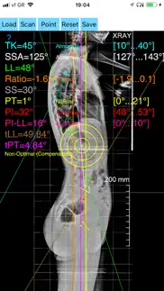 sagittalbalanceapp iphone screenshot 1