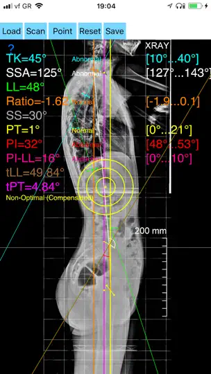 Screenshot von SagittalBalanceApp auf dem iPhone 1