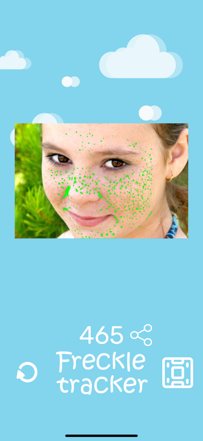 Freckle Tracker