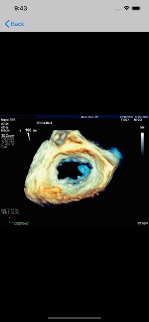 Texto de Cardiología SIAC RA(圖2)-速報App