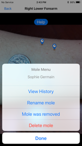 Mole Mapper Melanoma Study screenshot