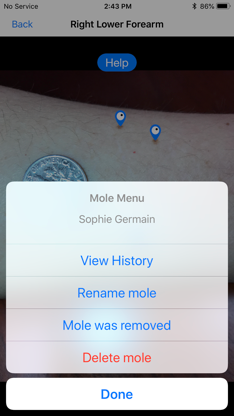 Mole Mapper Melanoma Study screenshot 5