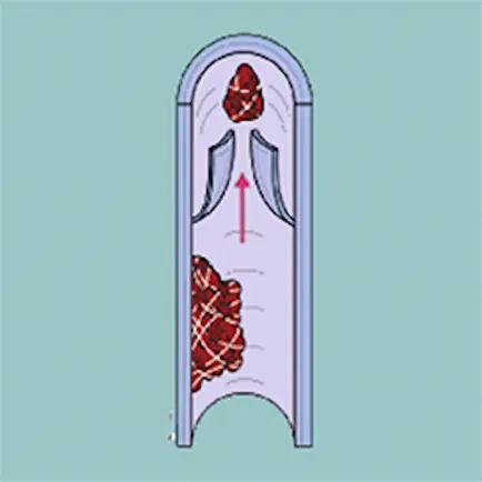 Thromboembolism Risk Cheats