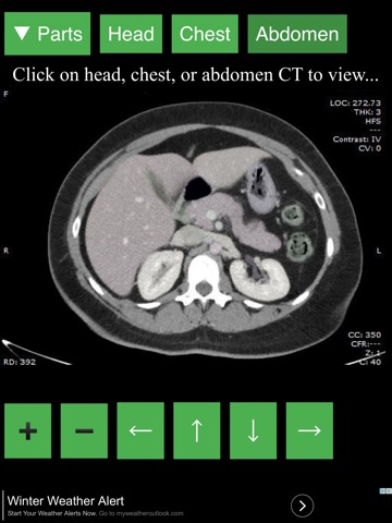 Anatomy on Radiology CTのおすすめ画像2