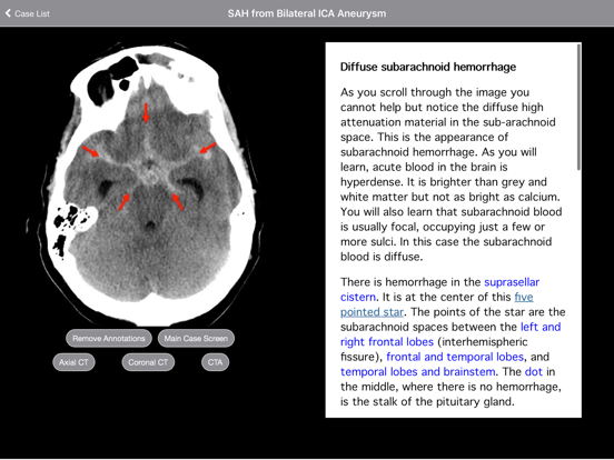 Radiology 2.0: Head CTs iPad screenshot 4 - Medical app