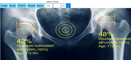 ReimersIndexApp