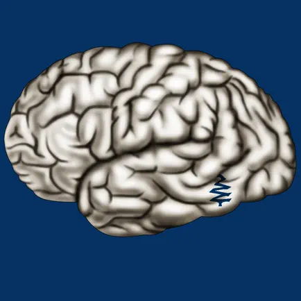 Cerebrum ID Читы