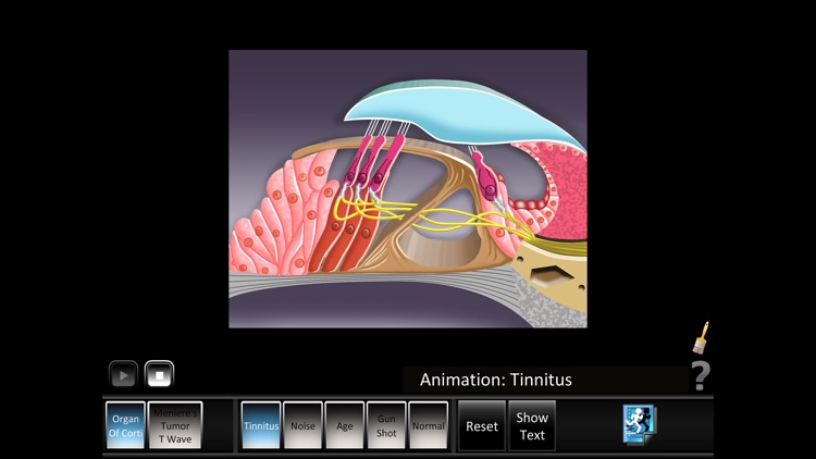 Ear Disorders: Inner