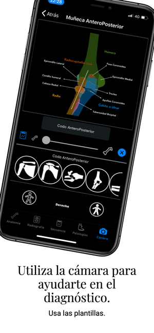 XRay Assistant(圖5)-速報App