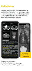 Gyn Cancer Staging Atlas screenshot #5 for iPhone