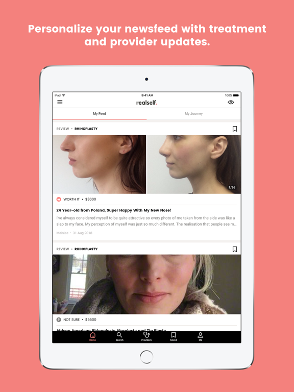 Screenshot #6 pour RealSelf: Treatments & Reviews
