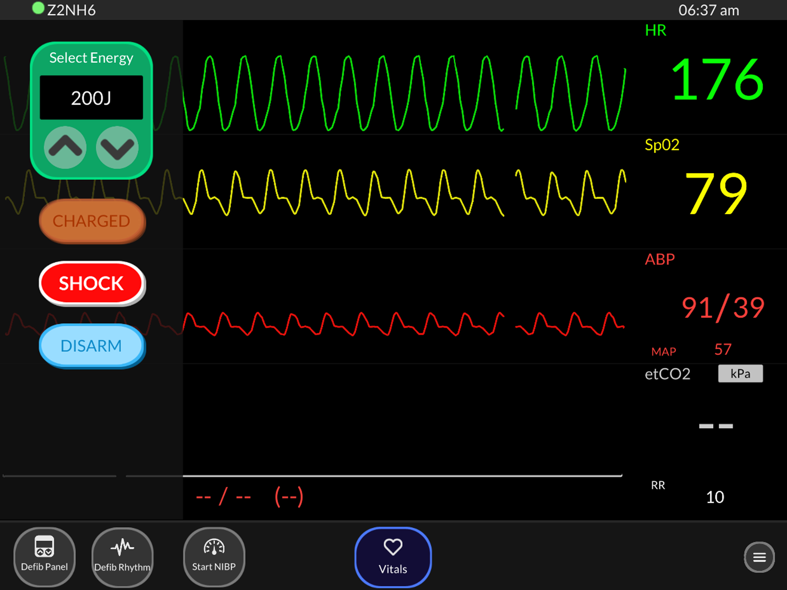 Simpl Patient Monitor