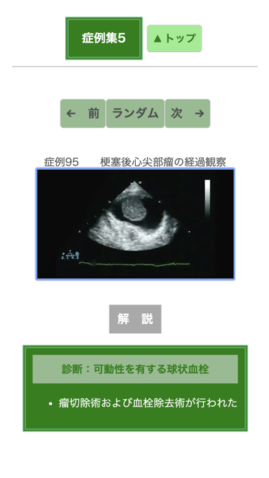 ポケット心エコー図のおすすめ画像7