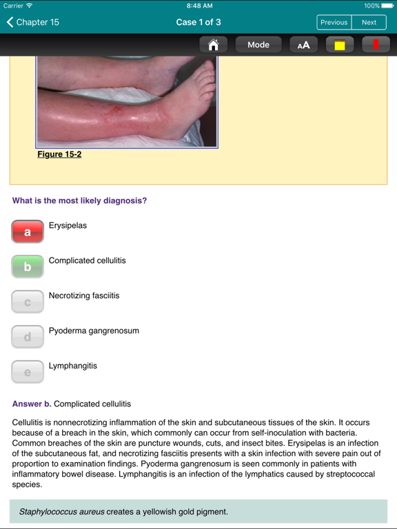 Screenshot #6 pour General Surgery CCS for USMLE