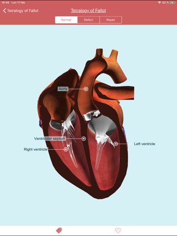 eMurmur Heartpediaのおすすめ画像3