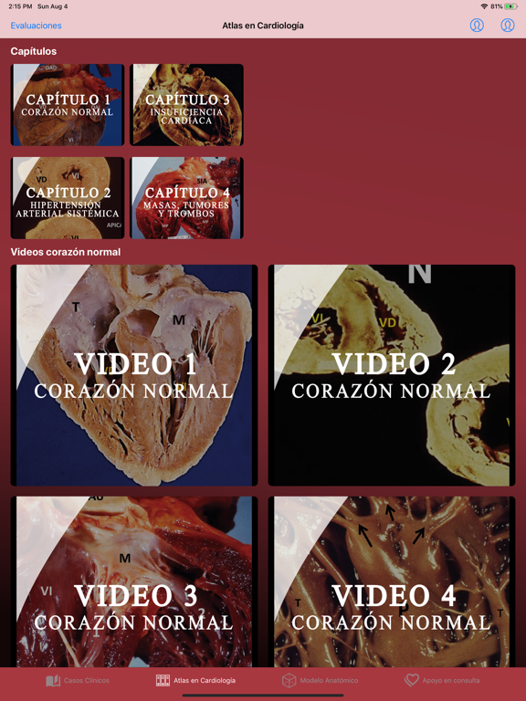 Screenshot #5 pour Update in Cardiology