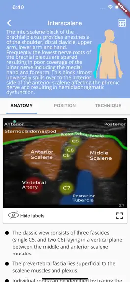 Game screenshot Regional Anesthesia Reference mod apk
