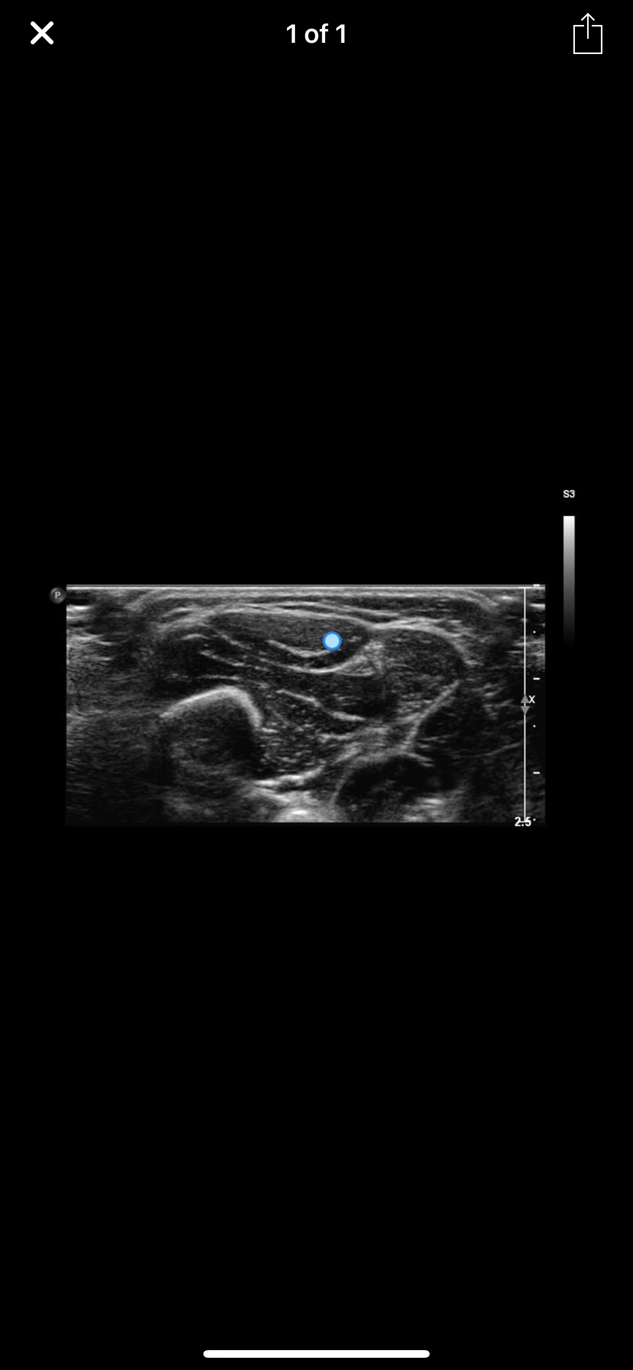 Muscle Ultrasound Course