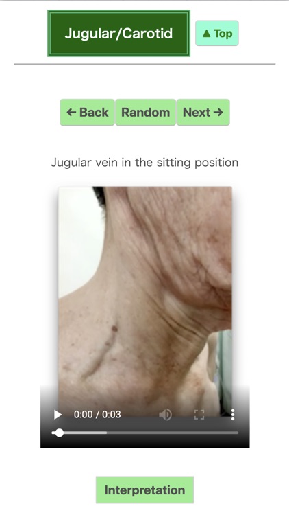 Pocket Heart Physical Exam screenshot-3