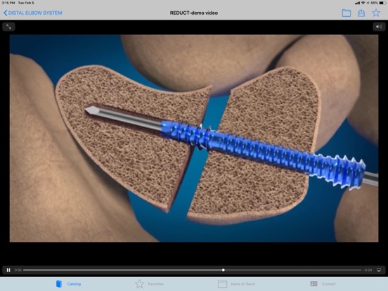 Screenshot #6 pour Skeletal Dynamics