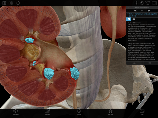 Physiology & Pathology iPad app afbeelding 4