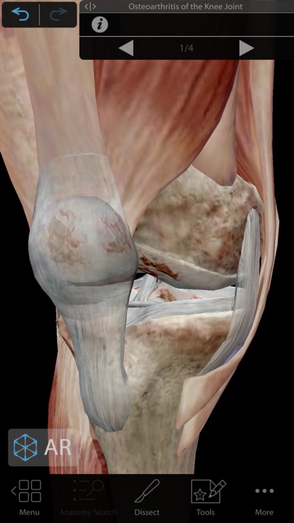 Muscles & Kinesiology screenshot-4