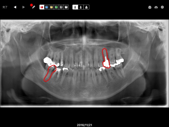 DentalXAirTreのおすすめ画像1