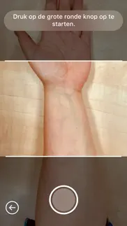 radboudumc wondgezond iphone capturas de pantalla 3