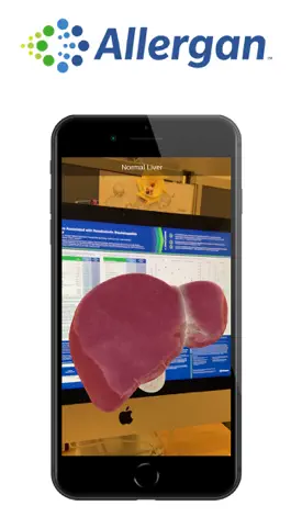 Game screenshot Allergan AR mod apk