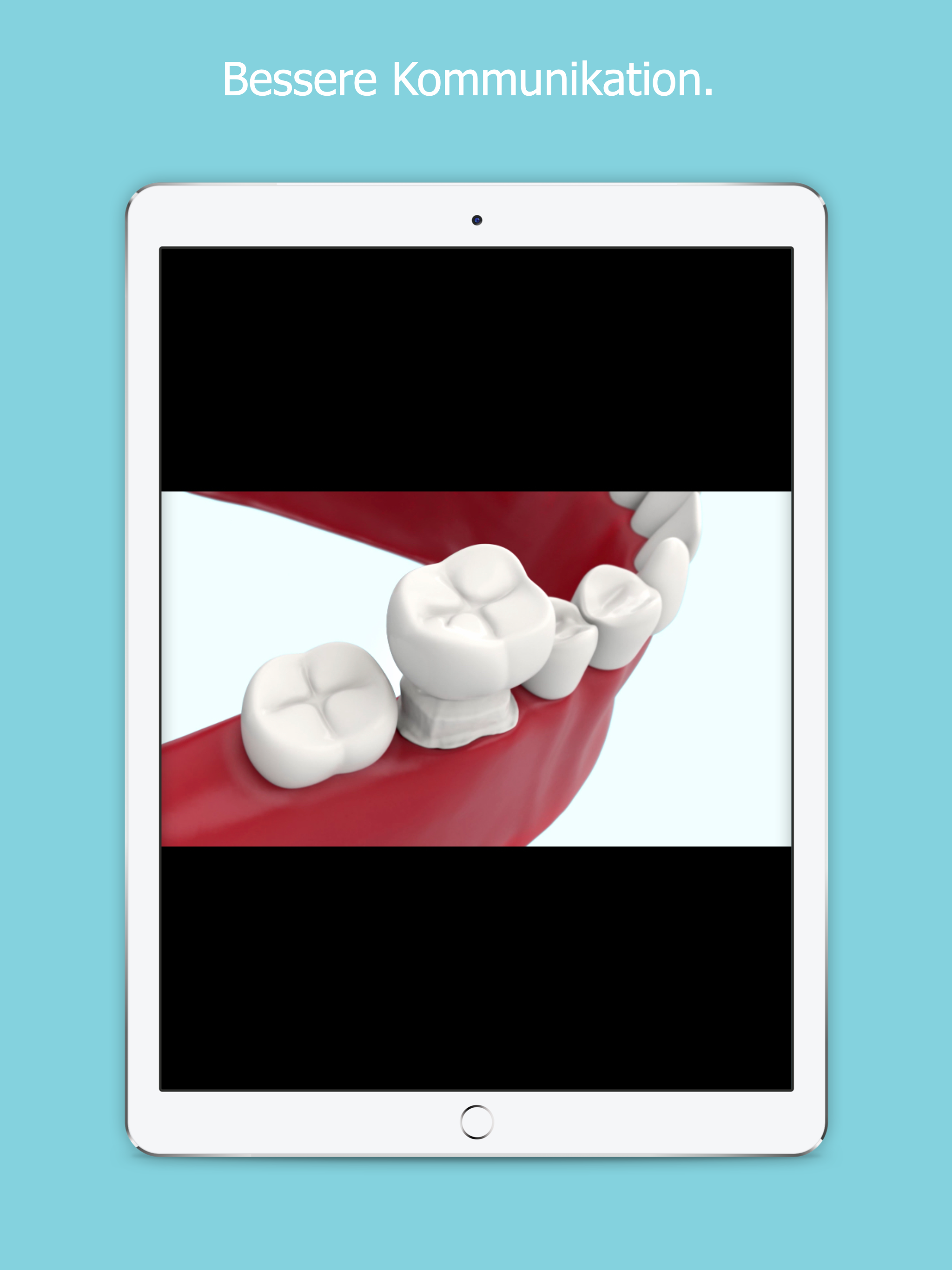 DentXplain