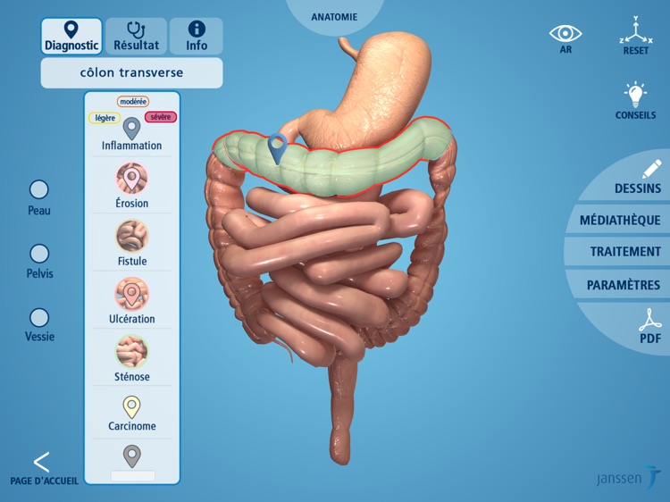 Application MICI screenshot-4