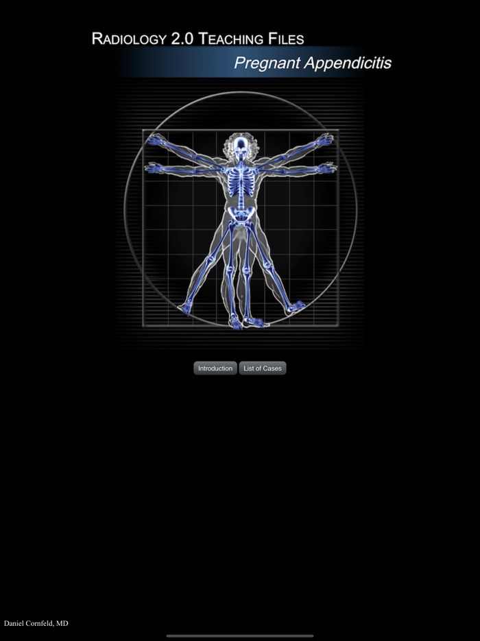 Pregnant Appendicitis