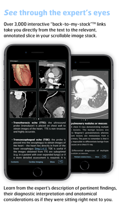 Thoracic Imaging Fundamentals screenshot 4